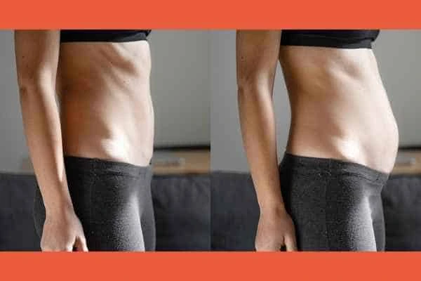 LA-EMS Body Sculpting results Solihull Lodge