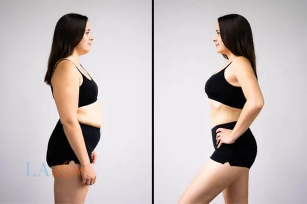 link between body image and mental health Solihull Lodge