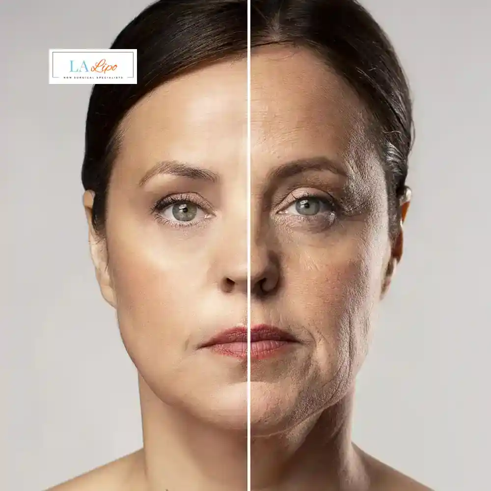 How Can You Tell If Non-Surgical Skin Tightening Is Right for You Solihull Lodge?